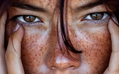 How stress affects the skin and what you can do about it