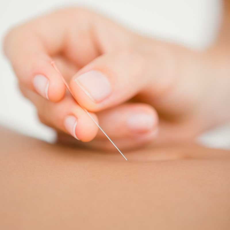 At The Mind Space Therapy Chester our licenced therapist offers a person-centred, tailored approach to mental health, specialising in hypnotherapy, Cognitive Behavioral Therapy (CBT), Mindfulness Training and Stress Management in and around Chester, Tarporley, Nantwich, Cheshire and the North West. Emma