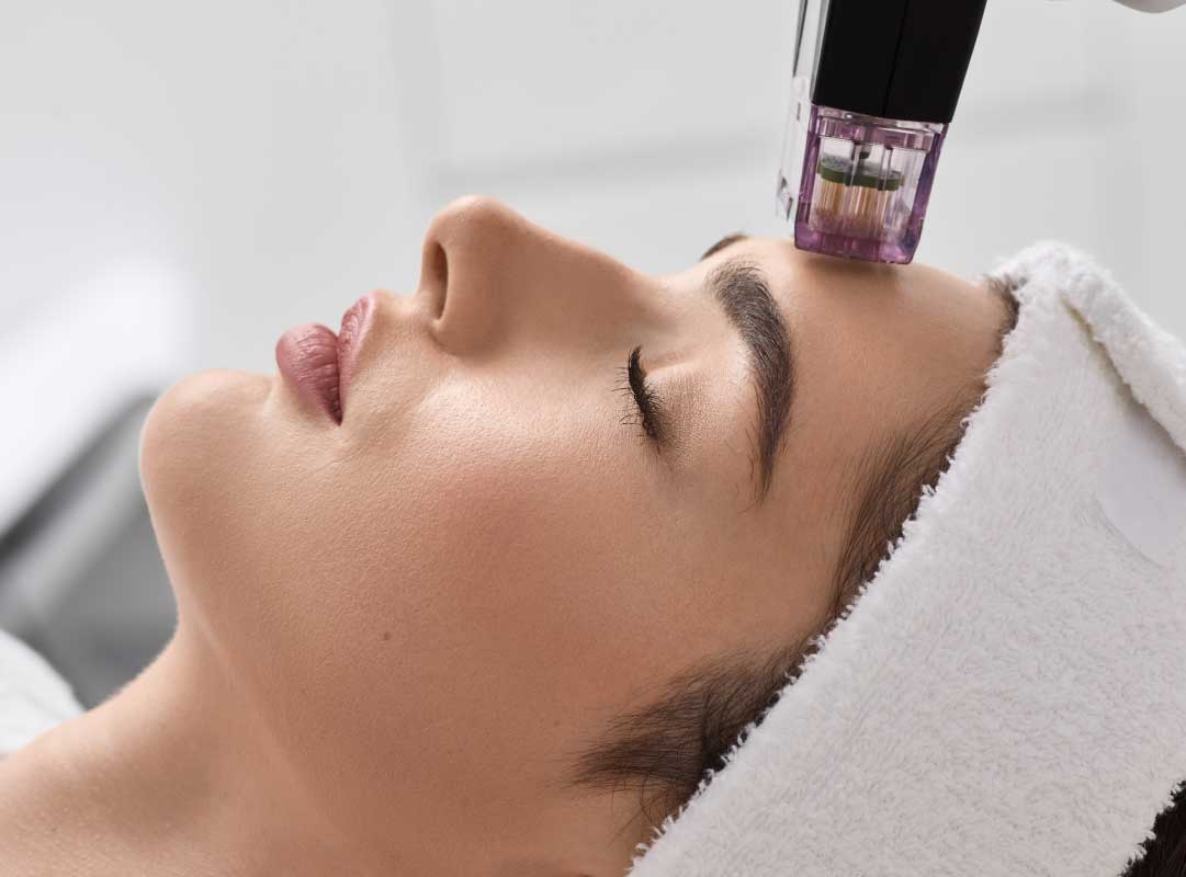 mciroderm2 At The Mind Space Therapy Chester our licenced therapist offers a person-centred, tailored approach to mental health, specialising in hypnotherapy, Cognitive Behavioral Therapy (CBT), Mindfulness Training and Stress Management in and around Chester, Tarporley, Nantwich, Cheshire and the North West. Emma